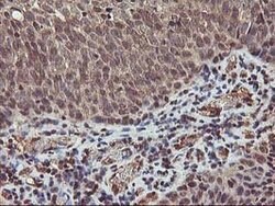 AKT1 Mouse anti-Canine, Human, Mouse, Rat, Clone: OTI4D6, lyophilized,