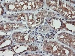 AKT1 Mouse anti-Canine, Human, Mouse, Rat, Clone: OTI4D6, lyophilized,