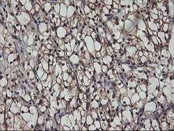 AKT1 Mouse anti-Canine, Human, Mouse, Rat, Clone: OTI4D6, lyophilized,