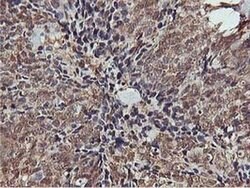 AKT1 Monoclonal Antibody (OTI3E3), TrueMAB , OriGene 100 &mu;L; Unconjugated:Antibodies,