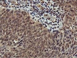 AKT1 Monoclonal Antibody (OTI3E3), TrueMAB , OriGene 100 &mu;L; Unconjugated:Antibodies,