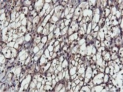 AKT1 Monoclonal Antibody (OTI3E3), TrueMAB , OriGene:Antibodies:Primary
