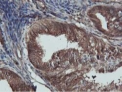 AKT1 Mouse anti-Canine, Human, Mouse, Rat, Clone: OTI4G4, lyophilized,
