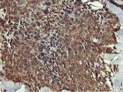 AKT1 Mouse anti-Canine, Human, Mouse, Rat, Clone: OTI4G4, lyophilized,