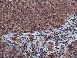 AKT1 Mouse anti-Canine, Human, Mouse, Rat, Clone: OTI4G4, lyophilized,
