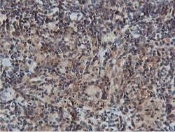 AKT1 Mouse anti-Canine, Human, Mouse, Rat, Clone: OTI4G4, lyophilized,