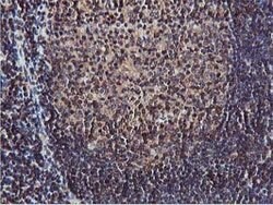 AKT1 Mouse anti-Canine, Human, Mouse, Rat, Clone: OTI4G4, lyophilized,