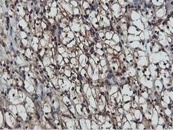 AKT1 Mouse anti-Canine, Human, Mouse, Rat, Clone: OTI4G4, lyophilized,