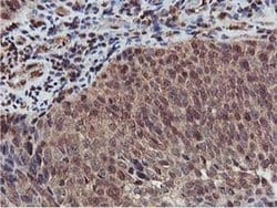AKT1 Monoclonal Antibody (OTI3B4), TrueMAB , OriGene 100 &mu;L; Unconjugated:Antibodies,