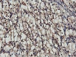 AKT1 Monoclonal Antibody (OTI3B4), TrueMAB , OriGene 100 &mu;L; Unconjugated:Antibodies,