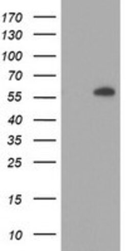 AKT1 Mouse anti-Canine, Human, Mouse, Rat, Clone: OTI4D6, lyophilized,