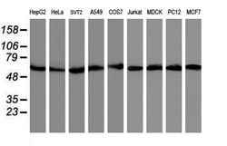 AKT1 Mouse anti-Canine, Human, Mouse, Rat, Clone: OTI4D6, lyophilized,