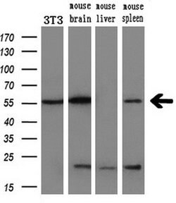 AKT1 Mouse anti-Canine, Human, Mouse, Rat, Clone: OTI4D6, lyophilized,