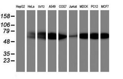 AKT1 Mouse anti-Canine, Human, Mouse, Rat, Clone: OTI4G4, lyophilized,