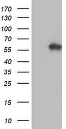 AKT1 Monoclonal Antibody (OTI3B4), TrueMAB , OriGene 100 &mu;L; Unconjugated:Antibodies,