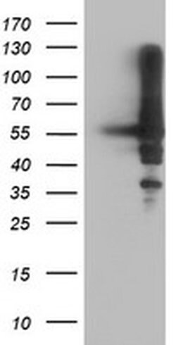 AKT1 Mouse anti-Canine, Human, Mouse, Rat, Clone: OTI4C11, liquid, TrueMAB