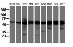 AKT1 Mouse anti-Canine, Human, Mouse, Rat, Clone: OTI4C11, liquid, TrueMAB