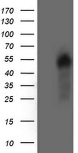 AKT1 Monoclonal Antibody (OTI2B9), TrueMAB , OriGene:Antibodies:Primary