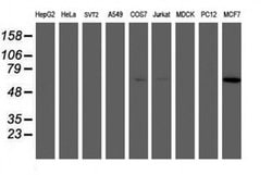 AKT1 Monoclonal Antibody (OTI2B9), TrueMAB , OriGene:Antibodies:Primary