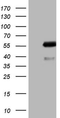 AKT1 Monoclonal Antibody (OTI1B2), TrueMAB , OriGene:Antibodies:Primary