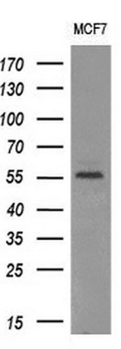AKT1 Monoclonal Antibody (OTI1B2), TrueMAB , OriGene 100 &mu;L; Unconjugated:Antibodies,