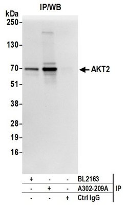 AKT2 Rabbit anti-Human, Polyclonal, Bethyl Laboratories 100 &mu;L; Unconjugated:Antibodies,