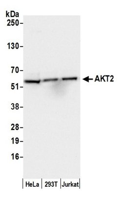 AKT2 Rabbit anti-Human, Polyclonal, Bethyl Laboratories 100 &mu;L; Unconjugated:Antibodies,