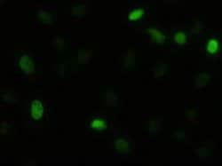 AKT3 Mouse anti-Human, Mouse, Clone: OTI9H8, liquid, TrueMAB 100 &mu;L;