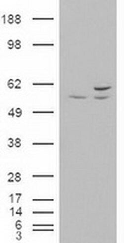 AKT3 Mouse anti-Human, Mouse, Clone: OTI9H8, liquid, TrueMAB 100 &mu;L;