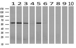 AKT3 Mouse anti-Human, Mouse, Clone: OTI9H8, liquid, TrueMAB 100 &mu;L;