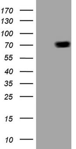 ALAS1 Monoclonal Antibody (OTI5D5), TrueMAB , OriGene 100 &mu;L; Unconjugated:Antibodies,