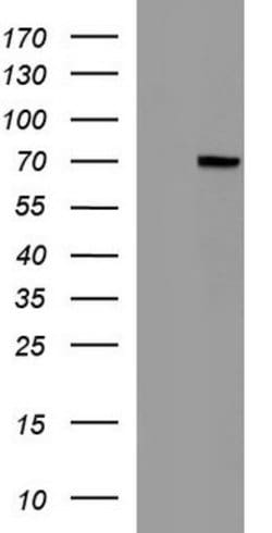 ALB Mouse anti-Human, Clone: OTI3B10, lyophilized, TrueMAB 100 &mu;g; Unconjugated:Antibodies,