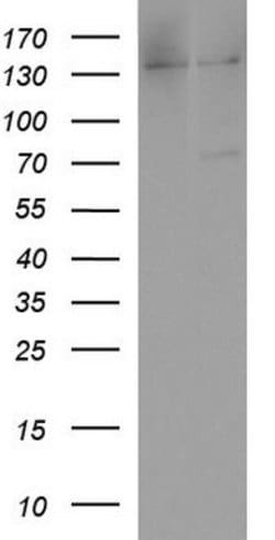 ALB Mouse anti-Human, Clone: OTI4D11, lyophilized, TrueMAB 100 &mu;g; Unconjugated:Antibodies,