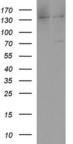 ALB Monoclonal Antibody (OTI4D11), TrueMAB , OriGene 100 &mu;L; Unconjugated:Antibodies,