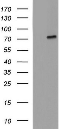 ALB Monoclonal Antibody (OTI3H8), TrueMAB , OriGene:Antibodies:Primary