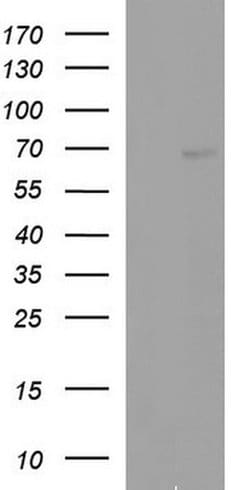 ALB Monoclonal Antibody (OTI5H2), TrueMAB , OriGene 30 &mu;L; Unconjugated:Antibodies,
