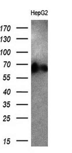 ALB Monoclonal Antibody (OTI5H2), TrueMAB , OriGene 30 &mu;L; Unconjugated:Antibodies,