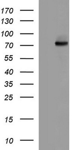 ALB Monoclonal Antibody (OTI3A10), TrueMAB , OriGene:Antibodies:Primary