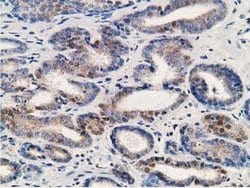 ALDH1A3 Mouse anti-Canine, Human, Clone: OTI4B6, lyophilized, TrueMAB 100