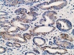 ALDH1A3 Mouse anti-Canine, Human, Clone: OTI4B6, liquid, TrueMAB 100 &mu;L;