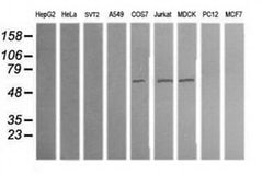 ALDH1A3 Mouse anti-Canine, Human, Clone: OTI4B6, liquid, TrueMAB 100 &mu;L;