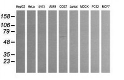 ALDH1A3 Monoclonal Antibody (OTI4A3), TrueMAB , OriGene 30 &mu;L; Unconjugated:Antibodies,