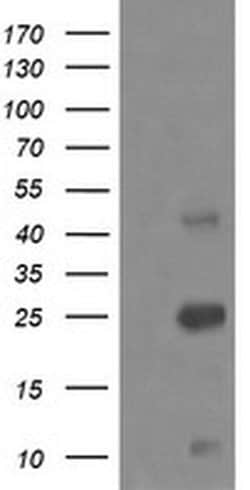 ALDH1A3 Monoclonal Antibody (OTI4A3), TrueMAB , OriGene 30 &mu;L; Unconjugated:Antibodies,