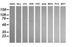 ALDH1A3 Monoclonal Antibody (OTI4B4), TrueMAB , OriGene 30 &mu;L; Unconjugated:Antibodies,