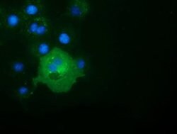 ALDH1L1 Monoclonal Antibody (OTI4D5), TrueMAB , OriGene 30 &mu;L; Unconjugated:Antibodies,
