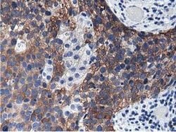 ALDH1L1 Monoclonal Antibody (OTI3D2), TrueMAB , OriGene:Antibodies:Primary