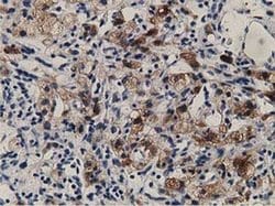 ALDH1L1 Monoclonal Antibody (OTI3D2), TrueMAB , OriGene 30 &mu;L; Unconjugated:Antibodies,