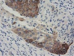 ALDH1L1 Monoclonal Antibody (OTI3B11), TrueMAB , OriGene 30 &mu;L; Unconjugated:Antibodies,