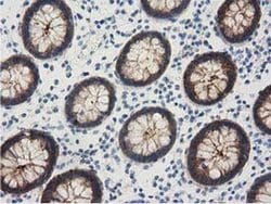 ALDH1L1 Monoclonal Antibody (OTI3B11), TrueMAB , OriGene 30 &mu;L; Unconjugated:Antibodies,