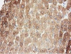 ALDH1L1 Monoclonal Antibody (OTI3B11), TrueMAB , OriGene 30 &mu;L; Unconjugated:Antibodies,